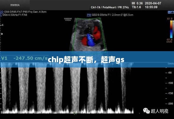 chip超声不断，超声gs 