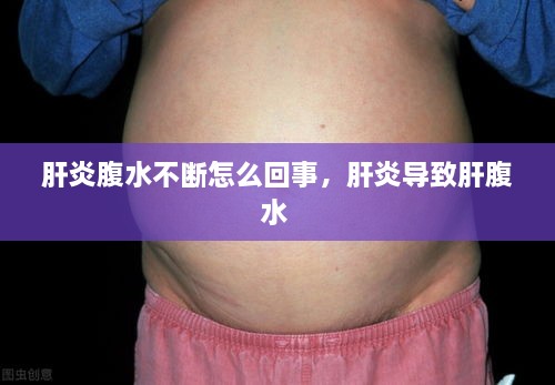 高抬贵手 第2页
