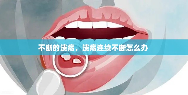 不断的溃疡，溃疡连续不断怎么办 