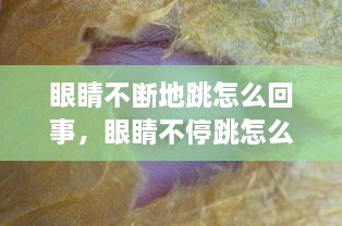 眼睛不断地跳怎么回事，眼睛不停跳怎么办 