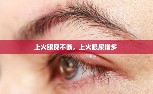 上火眼屎不断，上火眼屎增多 